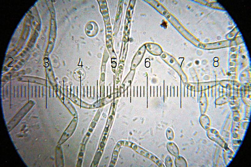 Mildew growing on a plastic shower curtain.

  100× oil-immersion objective, 15× eyepiece; the numbered ticks on the scale are eleven (11) microns apart.  (Yes,